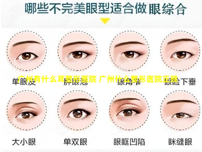 广州有什么耳整形医院 广州什么整形医院正规